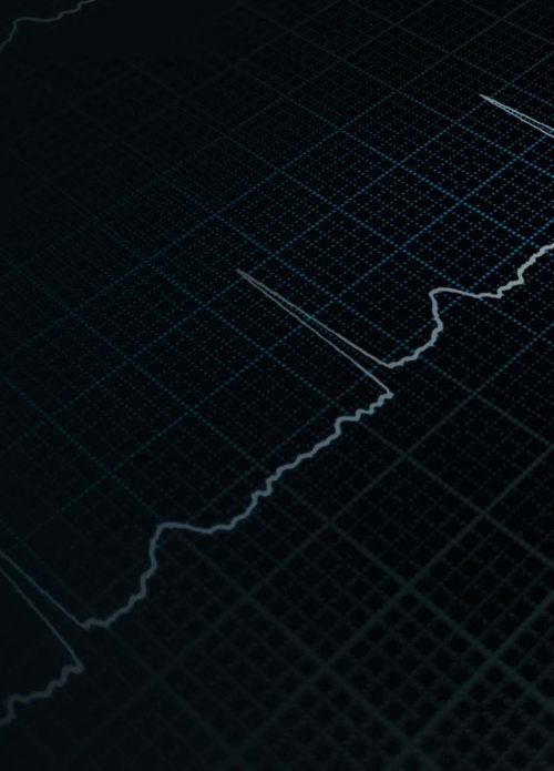 Making ECG Accessible at Home with OMRON Connect 2.0