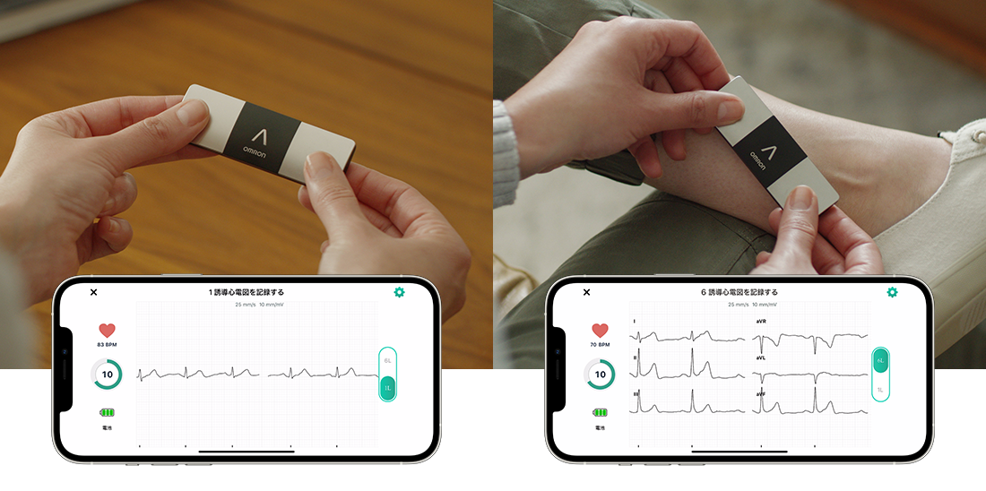 Early CVD Detection with BPM & ECG