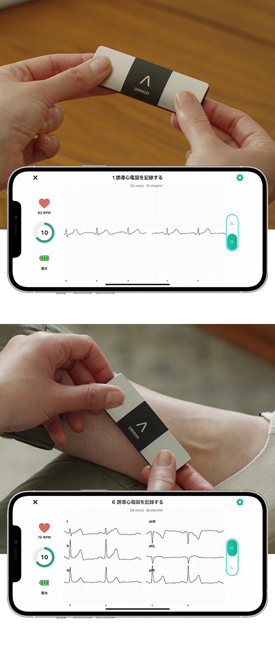 Early CVD Detection with BPM & ECG