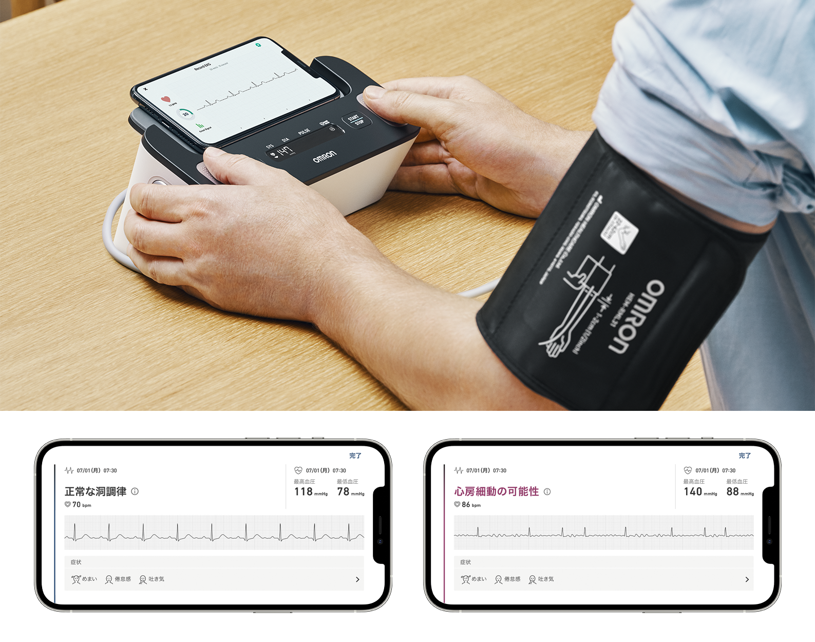 Omron Complete: EKG + Blood Monitor