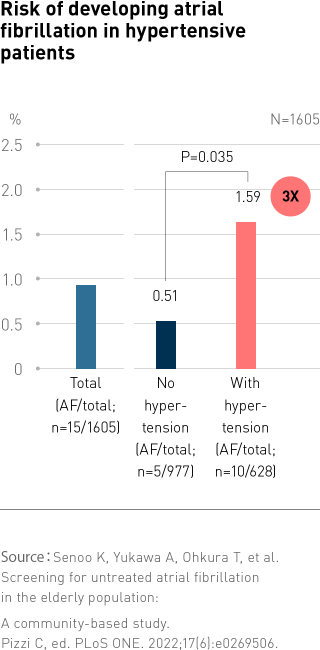 Early CVD Detection with BPM & ECG