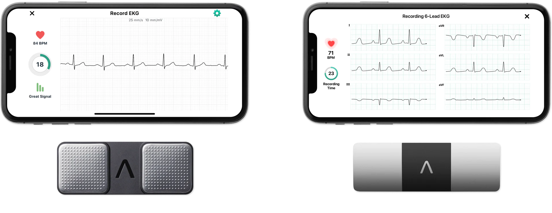 OMRON Healthcare Launches Breakthrough in Home ECG and Blood Pressure  Monitoring 