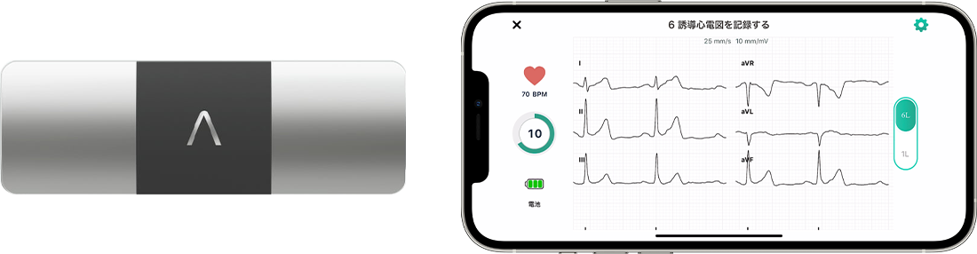 Portable electrocardiograph HCG-8060T with 6-induced electrocardiogram displayed in the app